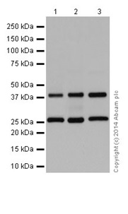 Western blot - Anti-DNAJB6 antibody [EPR17122] (ab198995)