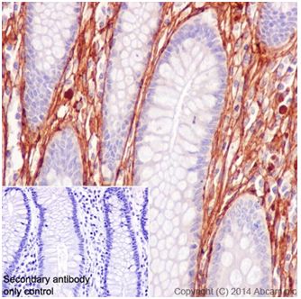 Immunohistochemistry (Formalin/PFA-fixed paraffin-embedded sections) - Anti-Collagen VI antibody [EPR17077] (ab199720)