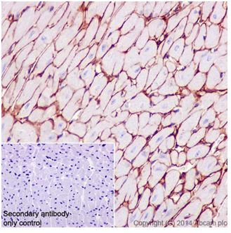 Immunohistochemistry (Formalin/PFA-fixed paraffin-embedded sections) - Anti-Collagen VI antibody [EPR17077] (ab199720)