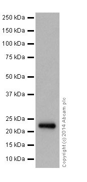 Western blot - Anti-NDUFB9 antibody [EPR15955-78] (ab200198)