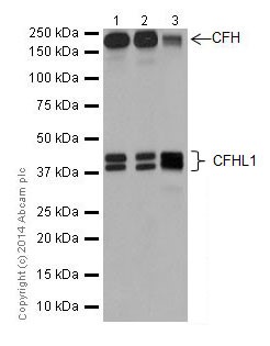 Western blot - Anti-CFH + CFHL1 antibody [EPR17159] (ab200656)