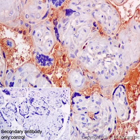 Immunohistochemistry (Formalin/PFA-fixed paraffin-embedded sections) - Anti-CFH + CFHL1 antibody [EPR17159] (ab200656)