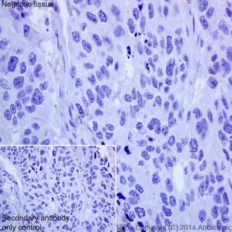 Immunohistochemistry (Formalin/PFA-fixed paraffin-embedded sections) - Anti-CFH + CFHL1 antibody [EPR17159] (ab200656)