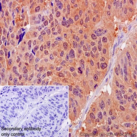 Immunohistochemistry (Formalin/PFA-fixed paraffin-embedded sections) - Anti-MTH1 antibody [EPR15934-50] (ab200832)