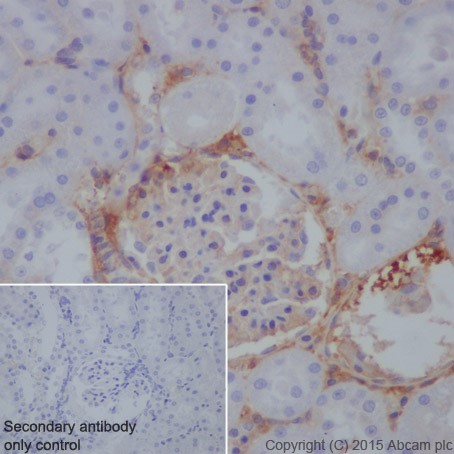 Immunohistochemistry (Formalin/PFA-fixed paraffin-embedded sections) - Anti-C3 antibody [EPR19394] (ab200999)