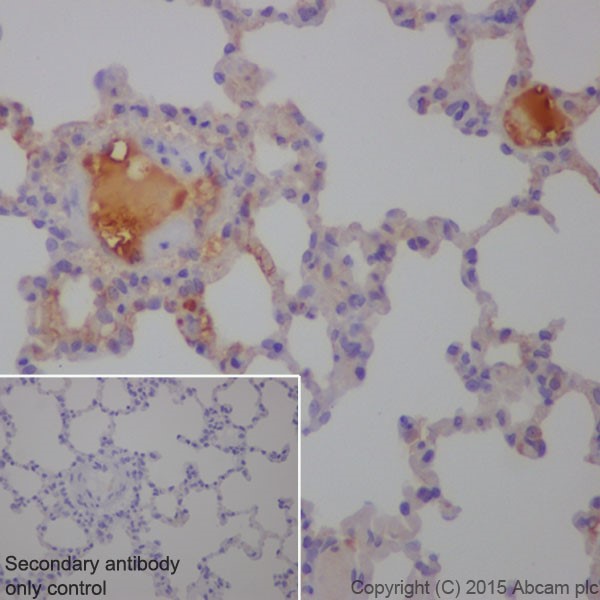 Immunohistochemistry (Formalin/PFA-fixed paraffin-embedded sections) - Anti-C3 antibody [EPR19394] (ab200999)