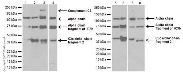 Western blot - Anti-C3 antibody [EPR19394] (ab200999)