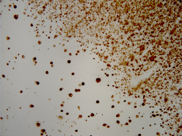 Immunohistochemistry - Free Floating - Anti-Amyloid Fibril antibody [mOC87] - Conformation-Specific (ab201062)