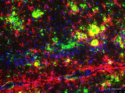 Immunohistochemistry (PFA perfusion fixed frozen sections) - Anti-Amyloid Fibril antibody [mOC87] - Conformation-Specific (ab201062)