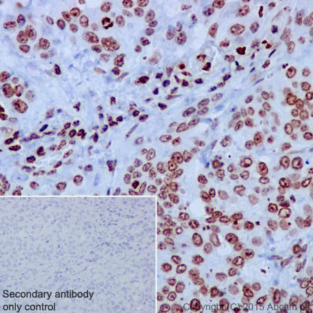 Immunohistochemistry (Formalin/PFA-fixed paraffin-embedded sections) - Anti-Histone H3 antibody [EPR17785] (ab201456)
