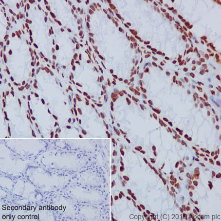 Immunohistochemistry (Formalin/PFA-fixed paraffin-embedded sections) - Anti-Histone H3 antibody [EPR17785] (ab201456)