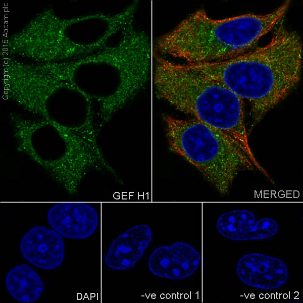 Immunocytochemistry/ Immunofluorescence - Anti-GEF H1 antibody [EPR17963] - C-terminal (ab201687)