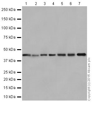Western blot - Anti-PIGK antibody [EPR17843] (ab201693)