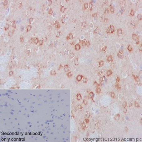 Immunohistochemistry (Formalin/PFA-fixed paraffin-embedded sections) - Anti-PMM1 antibody [EPR17844] (ab202058)