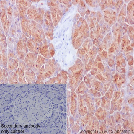 Immunohistochemistry (Formalin/PFA-fixed paraffin-embedded sections) - Anti-PMM1 antibody [EPR17844] (ab202058)