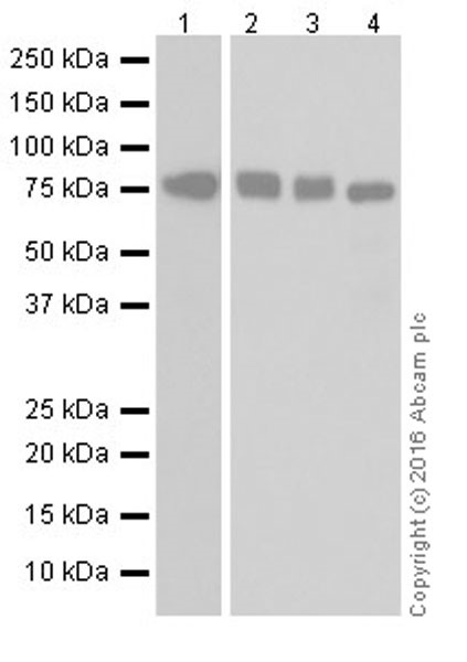 Western blot - Anti-MTHFR antibody [EPR19781] (ab203786)
