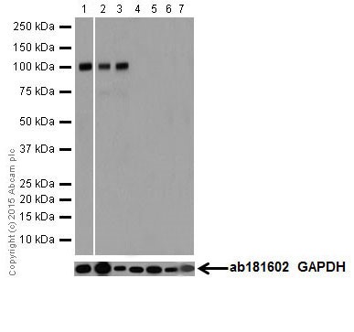 Western blot - Anti-Io<i></i>notropic Glutamate receptor 2 antibody [EPR18115] (ab206293)