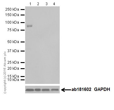 Western blot - Anti-BRSK1 antibody [EPR18190] (ab206298)