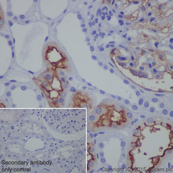 Immunohistochemistry (Formalin/PFA-fixed paraffin-embedded sections) - Anti-CD10 antibody [EPR5904-110] (ab208778)