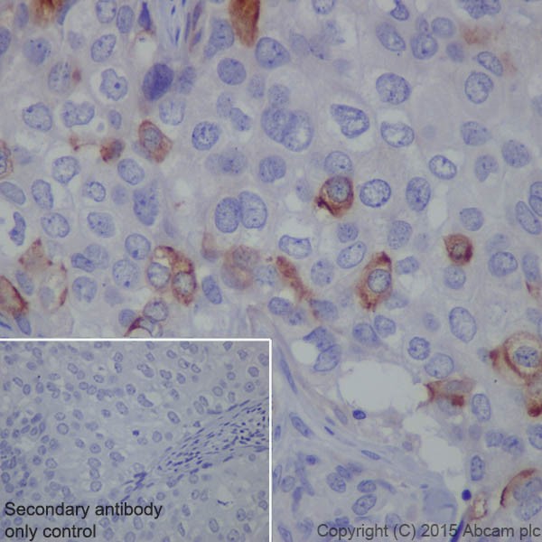 Immunohistochemistry (Formalin/PFA-fixed paraffin-embedded sections) - Anti-CD10 antibody [EPR5904-110] (ab208778)