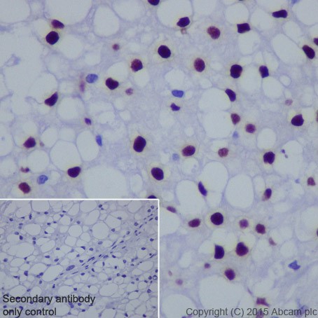 Immunohistochemistry (Formalin/PFA-fixed paraffin-embedded sections) - Anti-Brachyury / Bry antibody [EPR18113] (ab209665)