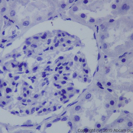 Immunohistochemistry (Formalin/PFA-fixed paraffin-embedded sections) - Anti-Brachyury / Bry antibody [EPR18113] (ab209665)