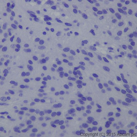 Immunohistochemistry (Formalin/PFA-fixed paraffin-embedded sections) - Anti-Brachyury / Bry antibody [EPR18113] (ab209665)