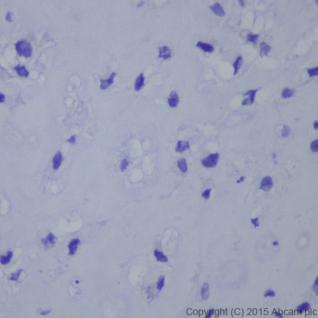 Immunohistochemistry (Formalin/PFA-fixed paraffin-embedded sections) - Anti-Brachyury / Bry antibody [EPR18113] (ab209665)