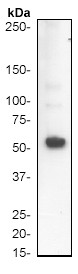 Western blot - Anti-Mutant p53 [Y5] antibody (ab32049)