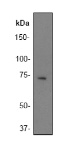 Western blot - BLNK antibody [Y491] (ab32418)