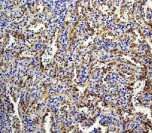 Immunohistochemistry (Formalin/PFA-fixed paraffin-embedded sections) - BLNK antibody [Y491] (ab32418)