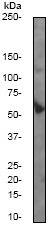 Western blot - Anti-Mutant p53 [E47] antibody (ab32509)