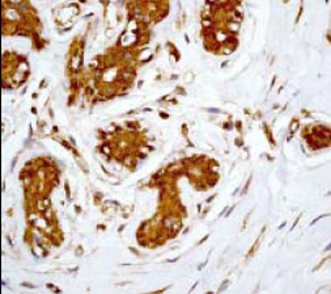 Immunohistochemistry (Formalin/PFA-fixed paraffin-embedded sections) - 14-3-3 alpha + beta antibody [Y62] (ab32560)