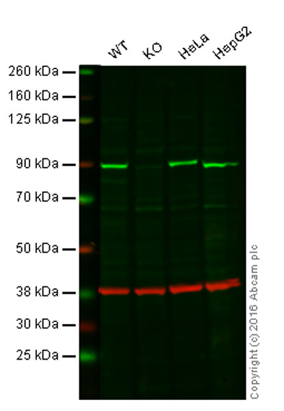 Western blot - Anti-NAK antibody [EP611Y] (ab40676)