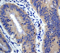 Immunohistochemistry (Paraffin-embedded sections) - APC antibody [EP701Y] (ab40778)