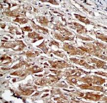 Immunohistochemistry (Paraffin-embedded sections) - alpha 1 Fetoprotein antibody [EP1017Y] (ab45147)