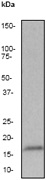 Western blot - Anti-gamma Synuclein antibody [EP1539Y] (ab52633)