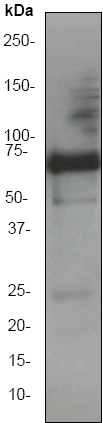 Western blot - alpha 1 Fetoprotein antibody [EP1016Y] (ab52940)