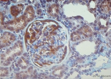 Immunohistochemistry (Formalin/PFA-fixed paraffin-embedded sections) - Anti-alpha Actinin antibody [EP2527Y] (ab68194)