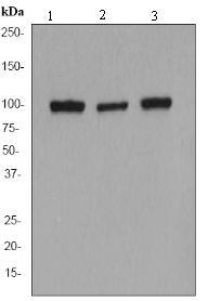 Western blot - alpha Actinin antibody [EP2527Y] (ab68194)