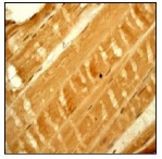 Immunohistochemistry (Formalin/PFA-fixed paraffin-embedded sections) - AMPK beta 1 (phospho S181) antibody [EP2181Y] (ab68206)