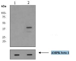 Western blot - Anti-AMPK beta 1 (phospho S181) antibody [EP2181Y] (ab68206)