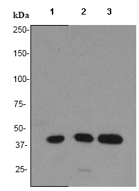 Western blot - Cdk9 antibody [EP3118] (ab75848)