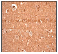 Immunohistochemistry (Formalin/PFA-fixed paraffin-embedded sections) - PARK7/DJ1 antibody [EP2815Y] (ab76008)