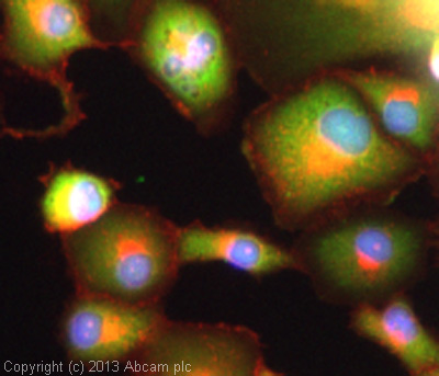 Immunocytochemistry/ Immunofluorescence - Anti-PARK7/DJ1 antibody [EP2815Y] (ab76008)