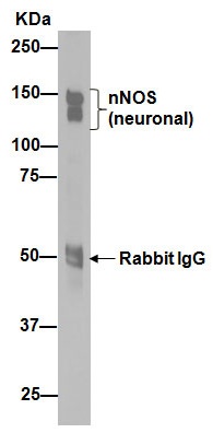 Immunoprecipitation - Anti-nNOS (neuronal) antibody [EP1855Y] (ab76067)