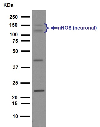 Western blot - Anti-nNOS (neuronal) antibody [EP1855Y] (ab76067)