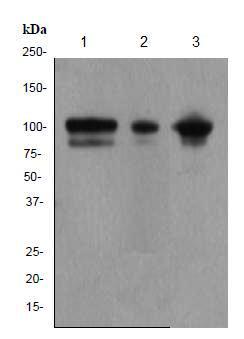 Western blot - Anti-alpha Actinin antibody [EP2528Y] (ab81265)