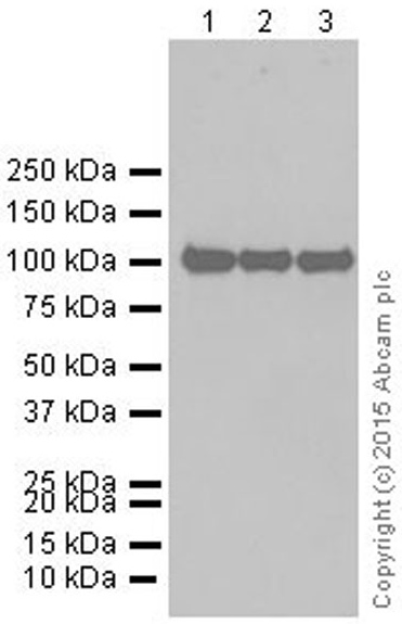 Western blot - Anti-alpha Actinin antibody [EP2528Y] (ab81265)