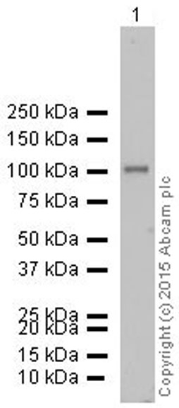 Western blot - Anti-alpha Actinin antibody [EP2528Y] (ab81265)